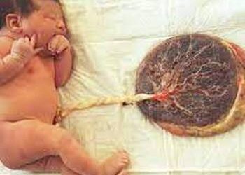 Stop Eating Placenta After Childbirth, Experts Warn New Mothers!