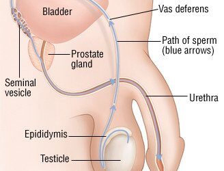 Male Infertility Explained