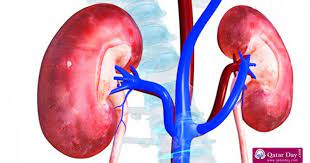 Here Are Top 6 Causes Of Kidney Disease