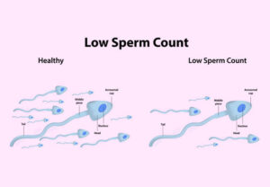 Low-Sperm Count