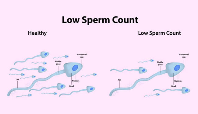 What Do You Do When You Have Lazy Or Too Few Sperm?