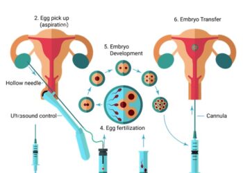 How IVF Can Help Couples Battling Infertility – Gynaecologist