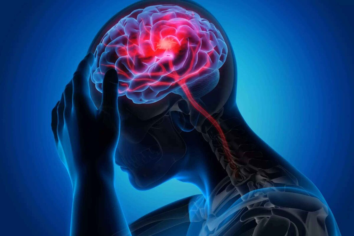 How To Prevent Recurrent Stroke — Study