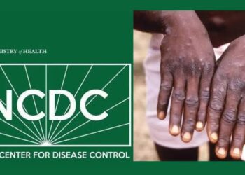 NCDC Says No Treatment For Monkeypox