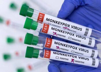 US Not Responsible For Monkeypox Spread In Nigerian Laboratories – Embassy