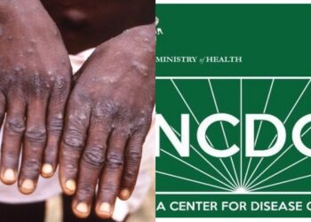 Nigeria Has No Laboratory Where Monkeypox Virus Is Generated – NCDC