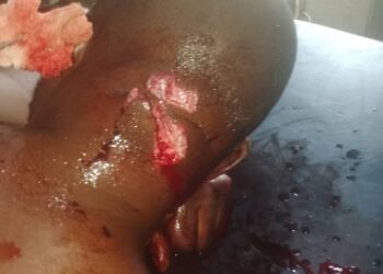 Unknown Gunmen Attack Five Members Of MWUN In Anambra