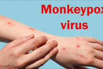 Monkeypox Cases Top 35,000 In 92 Countries – WHO