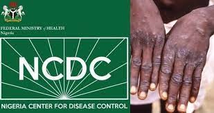 NCDC Confirms 157 Monkeypox Cases, Four Deaths