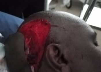 ANLCA Crisis: National President Alleges Hoodlums Sponsored By Faction Attacked Wale Cole