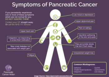 Five Early Warning Signs Of Pancreatic Cancer That Could Save A Life