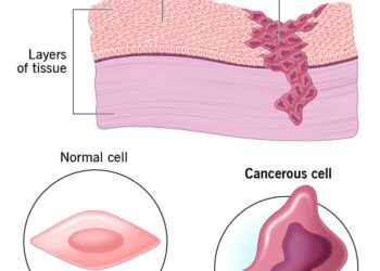 Men Beware, Wearing Tight Boxers Could Reduce Sperm Quality