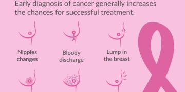 SPECIAL FOCUS: Understanding Breast Cancer