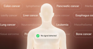 World Cancer Day: Cancer Not Always Death Sentence  Says Oncologist