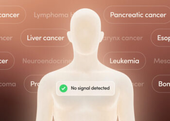 World Cancer Day: Cancer Not Always Death Sentence  Says Oncologist