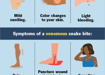 Snakebite Envenoming, Silent Killer In Nigeria – Expert Warns