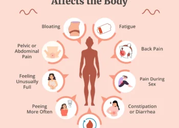 Ovarian Cancer: Why Nigerian Women Are Dying In Silence