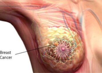 Experts, Survivor Harp On Early Detection To Enhance Cancer Treatment